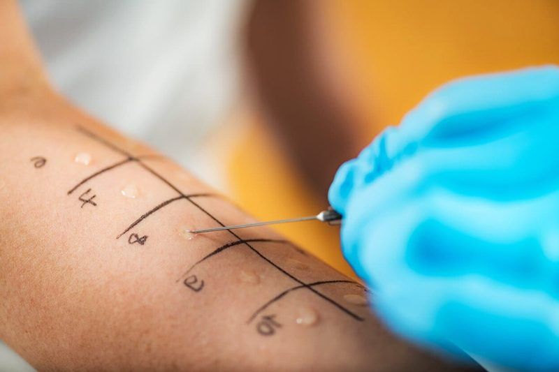 Allergy Test Quiz