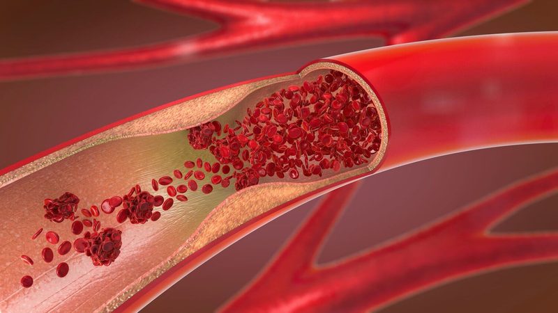 Arteries Quiz