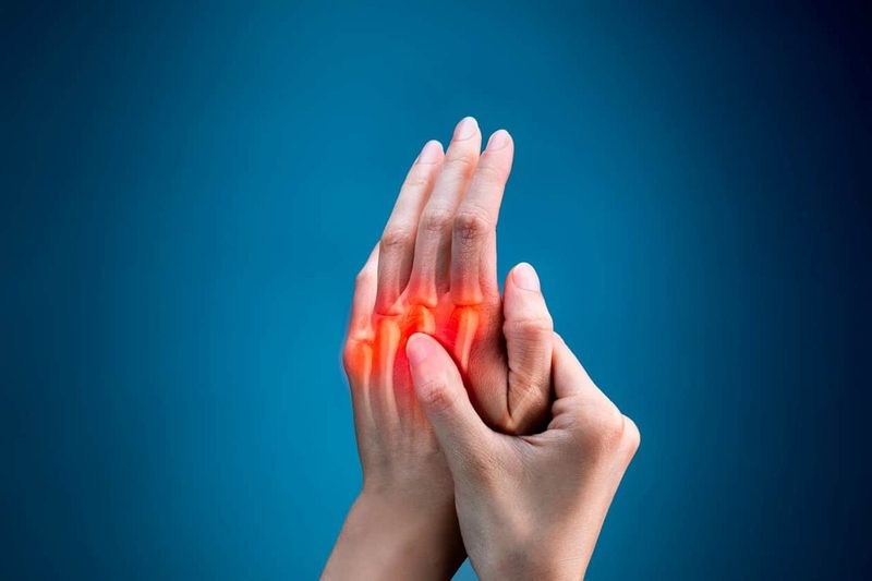 Arthritis Quiz