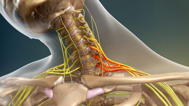 Brachial Plexus Quiz