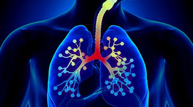 Bronchitis Quiz