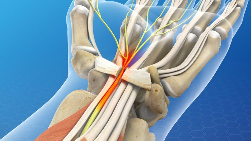Carpal Bones Quiz