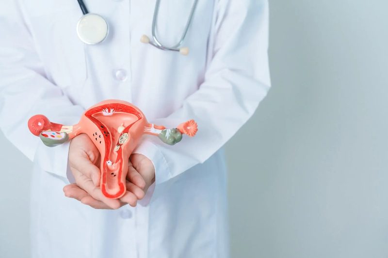 Cervical Cancer Quiz