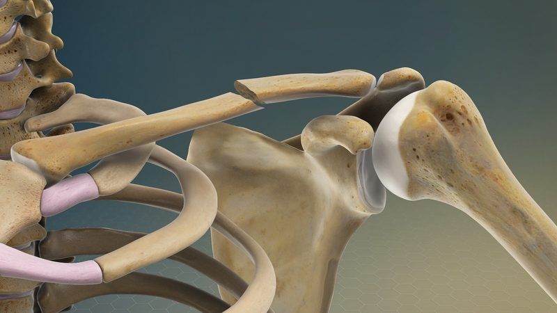 Clavicle Quiz