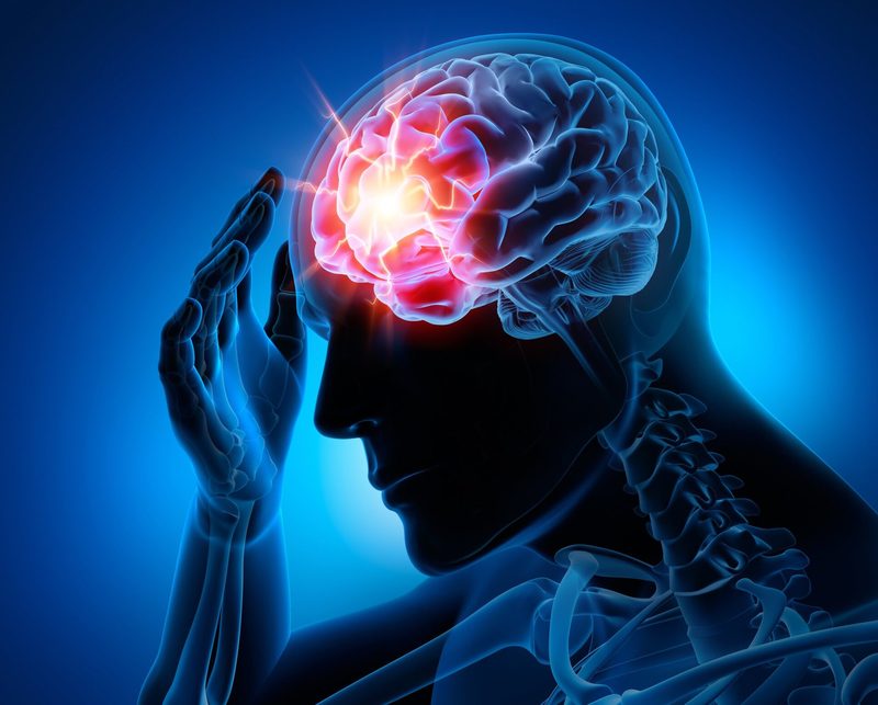 Concussion Quiz