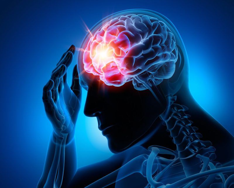 Concussion Quiz