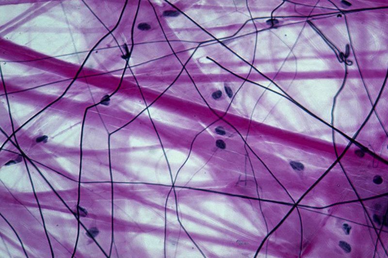 Connective Tissue Quiz