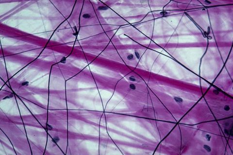 Connective Tissue Quiz