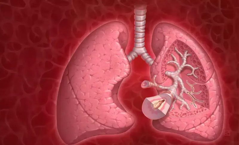 Copd Or Asthma Quiz
