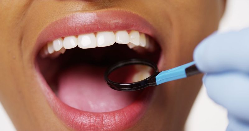 Dental Quiz