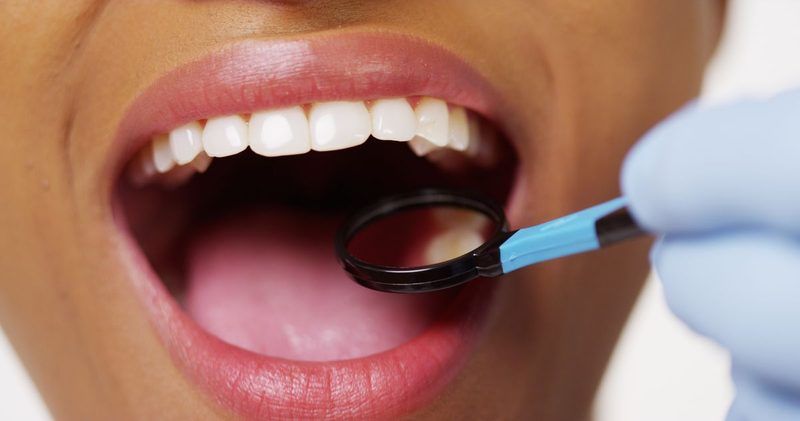 Dental Quiz