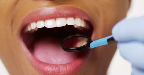 Dental Quiz