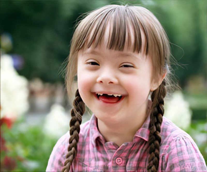 Down Syndrome Quiz