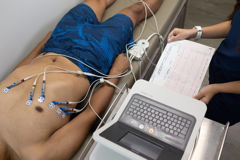 Ecg Quiz