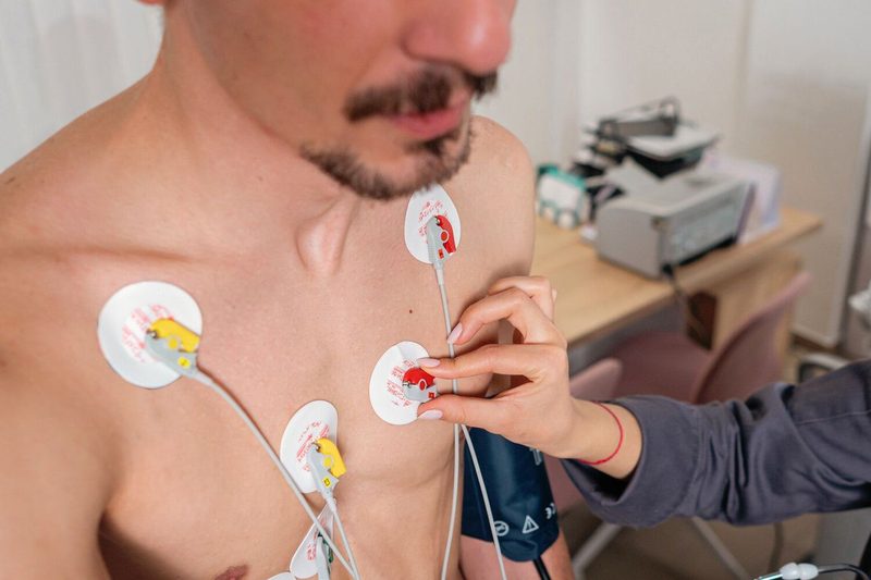 Ekg Quiz