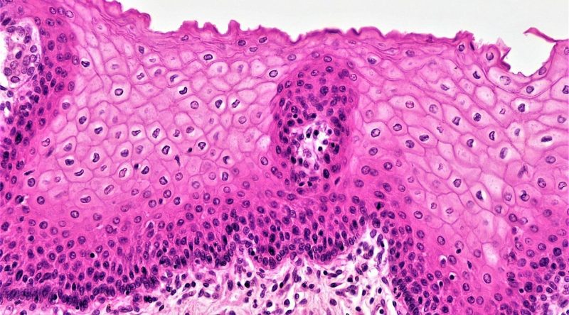 Epithelial Tissue Quiz