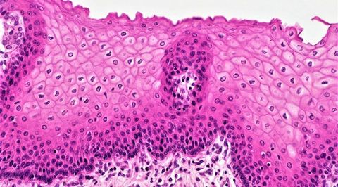 Epithelial Tissue Quiz