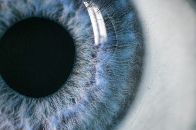 Eye Anatomy Quiz