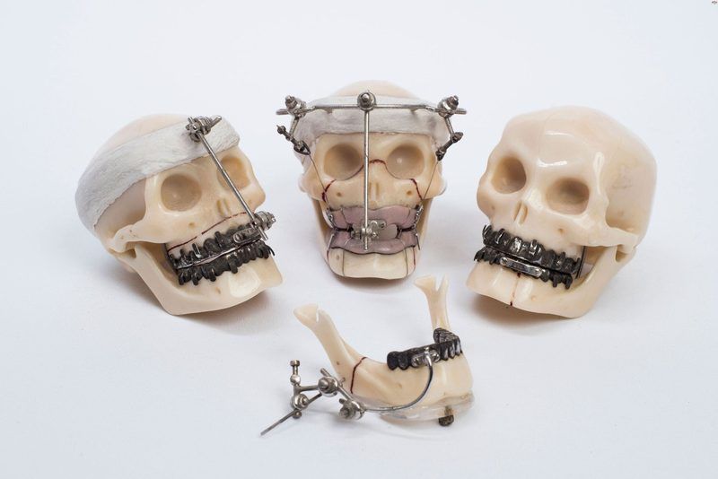 Facial Bones Quiz