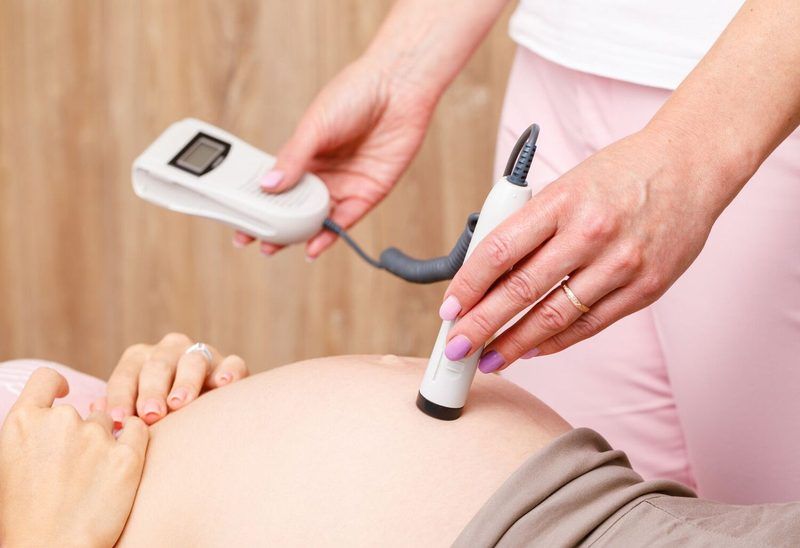 Fetal Monitoring Quiz