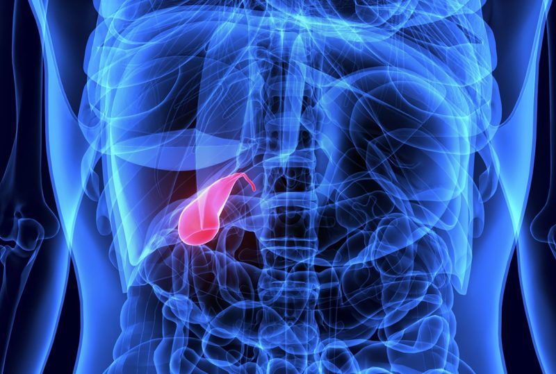 Gallbladder Removal Quiz
