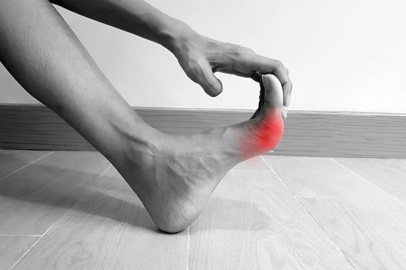 Gout Quiz
