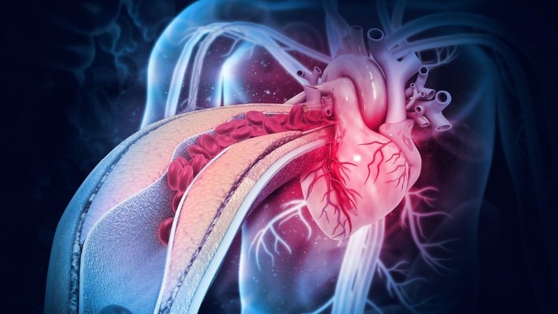 Heart Block Quiz