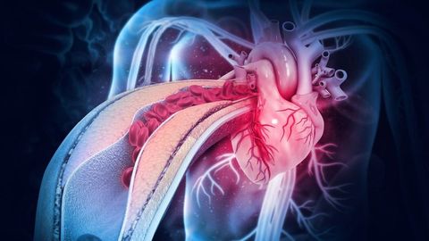 Heart Block Quiz
