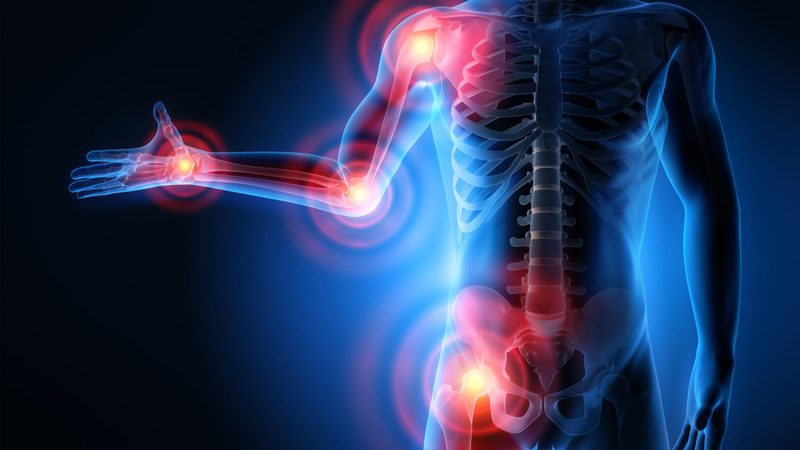 Inflammation Quiz
