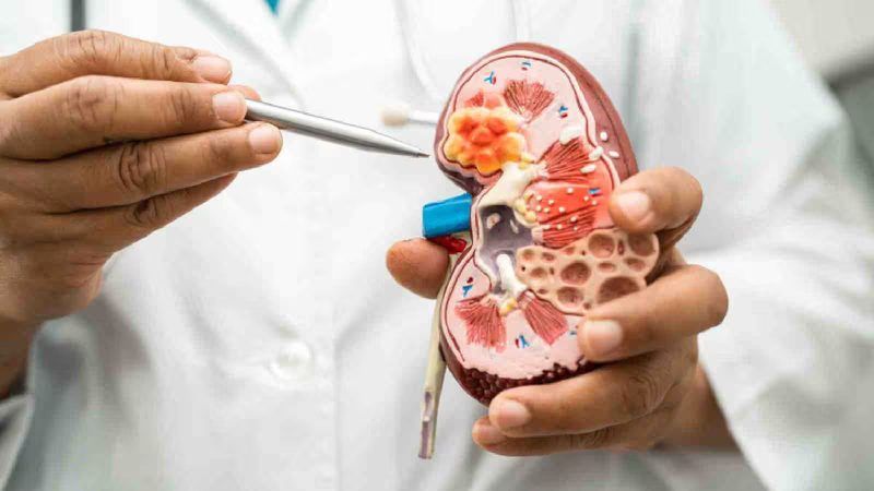 Kidney Health Quiz