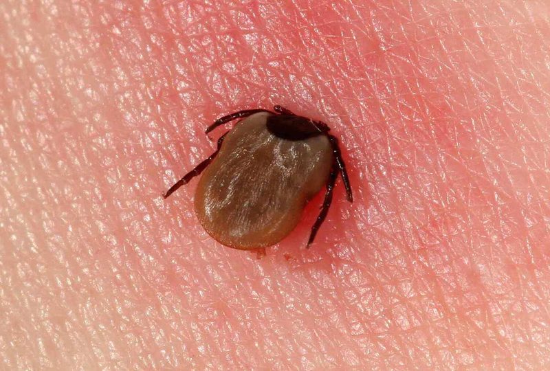 Lyme Disease Quiz