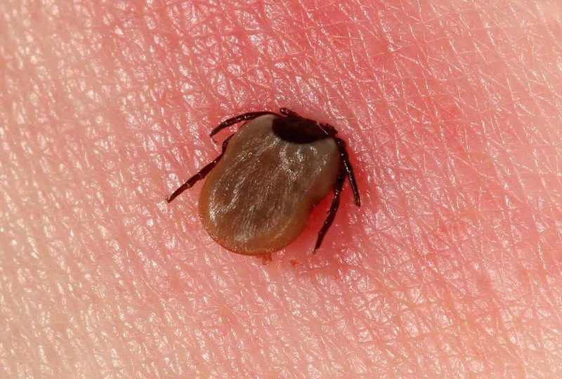 Lyme Disease Quiz