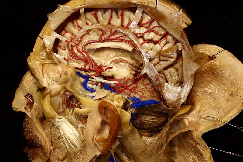 Neuroanatomy Quiz