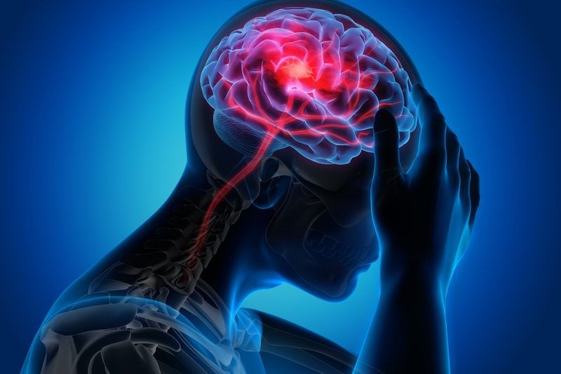 Neurological Disorder Quiz