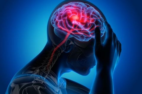 Neurological Disorder Quiz