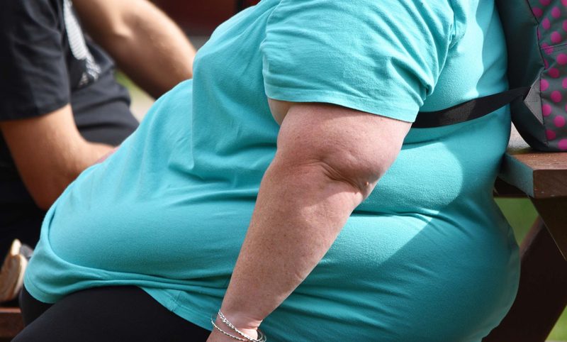 Obesity Quiz
