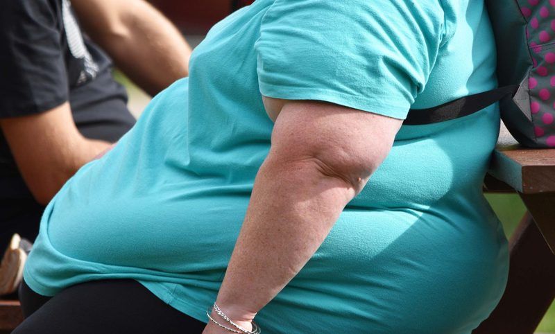 Obesity Quiz