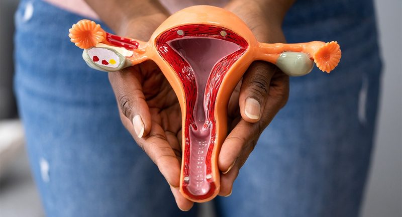 Ovarian Cancer Quiz