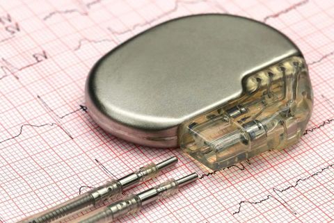 Pacemaker Quiz