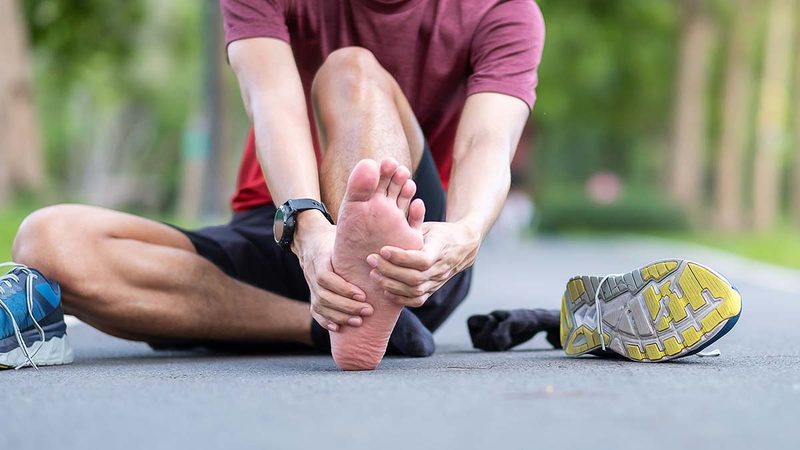 Plantar Fasciitis Quiz