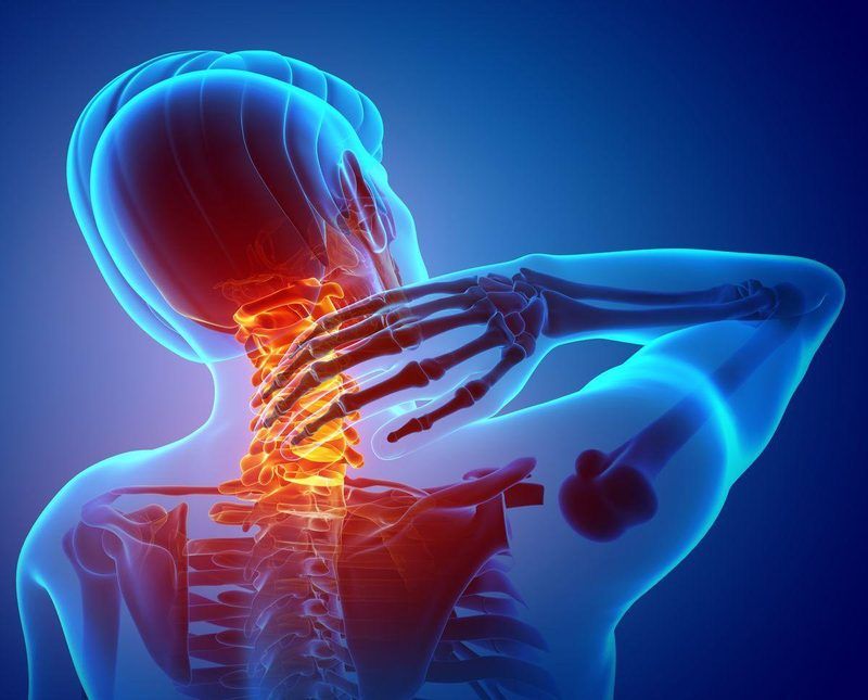 Polymyalgia Rheumatica Quiz