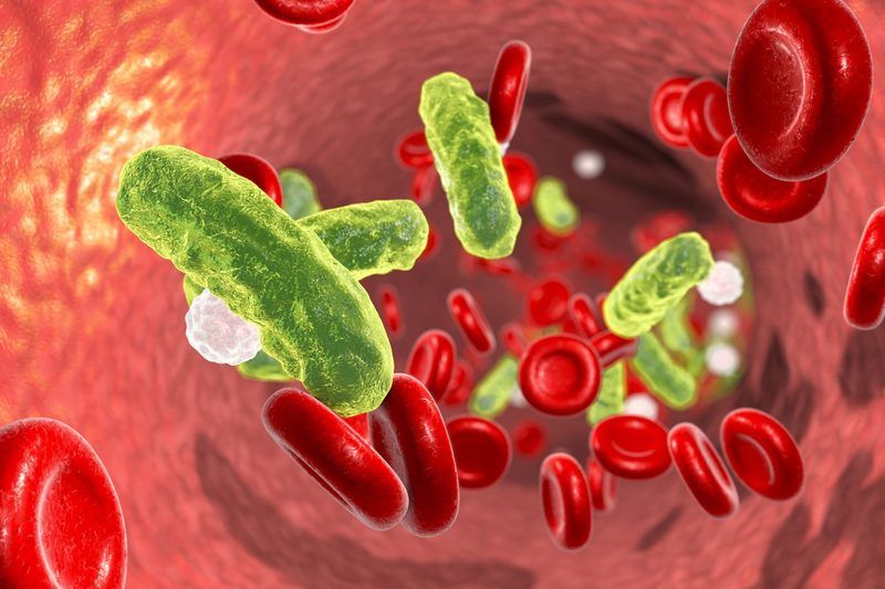 Sepsis Quiz