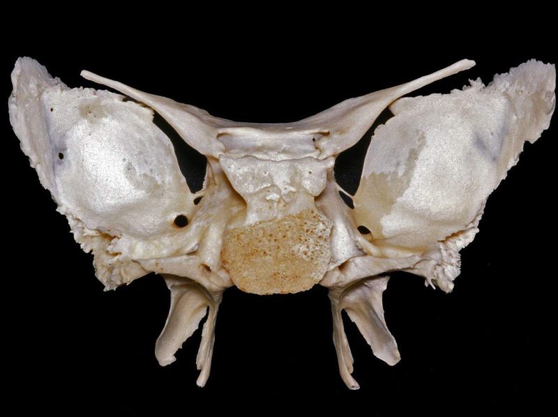 Sphenoid Bone Quiz
