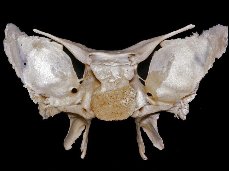 Sphenoid Bone Quiz