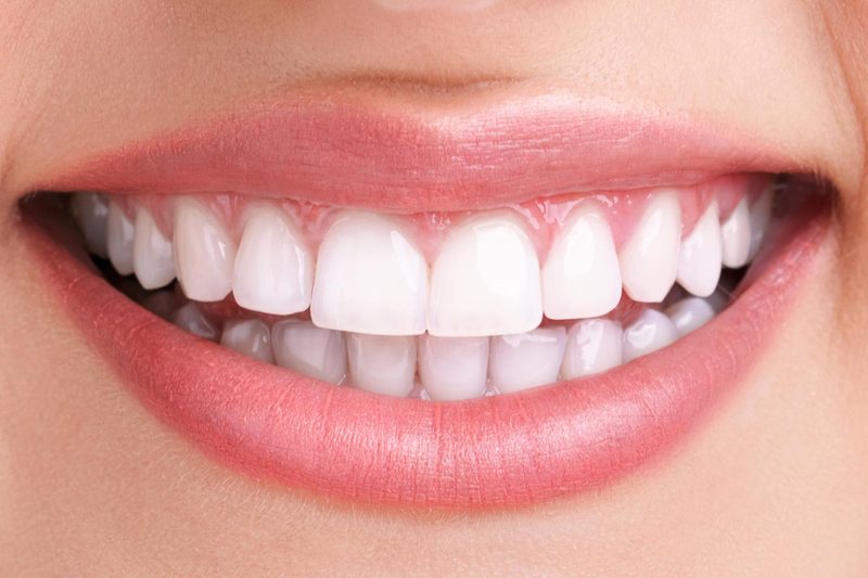 Teeth Quiz