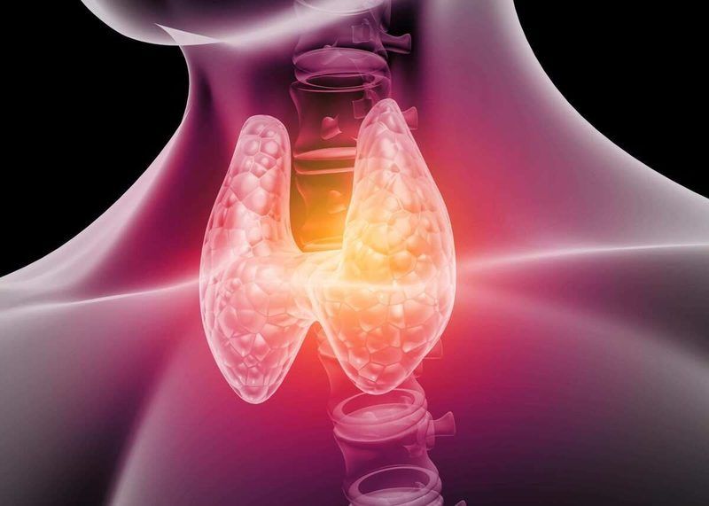 Thyroid Quiz