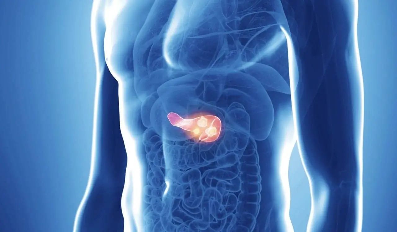 pancreatic-cancer-quiz