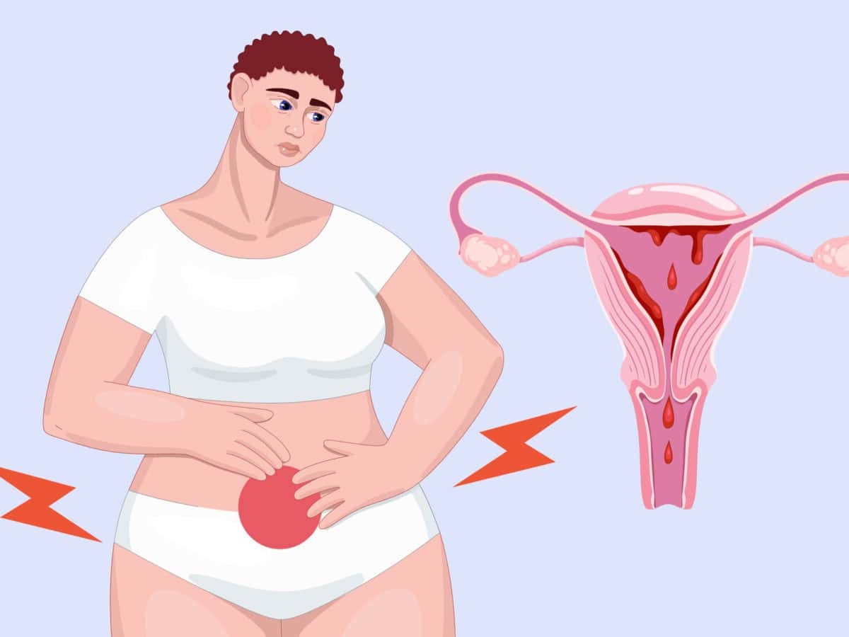 period-or-miscarriage-quiz