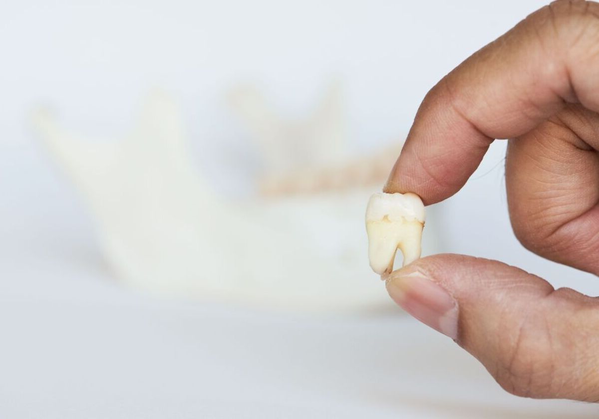 Tooth Identification Quiz