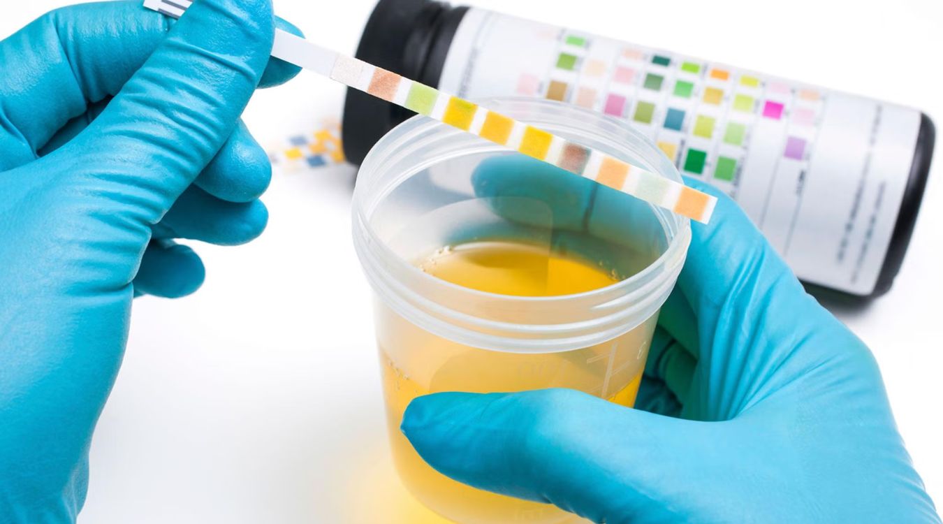UTI or Yeast Infection Quiz